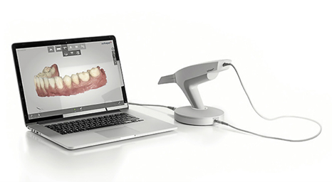 Сканирование полости рта для создания виртуальной 3D-модели.png